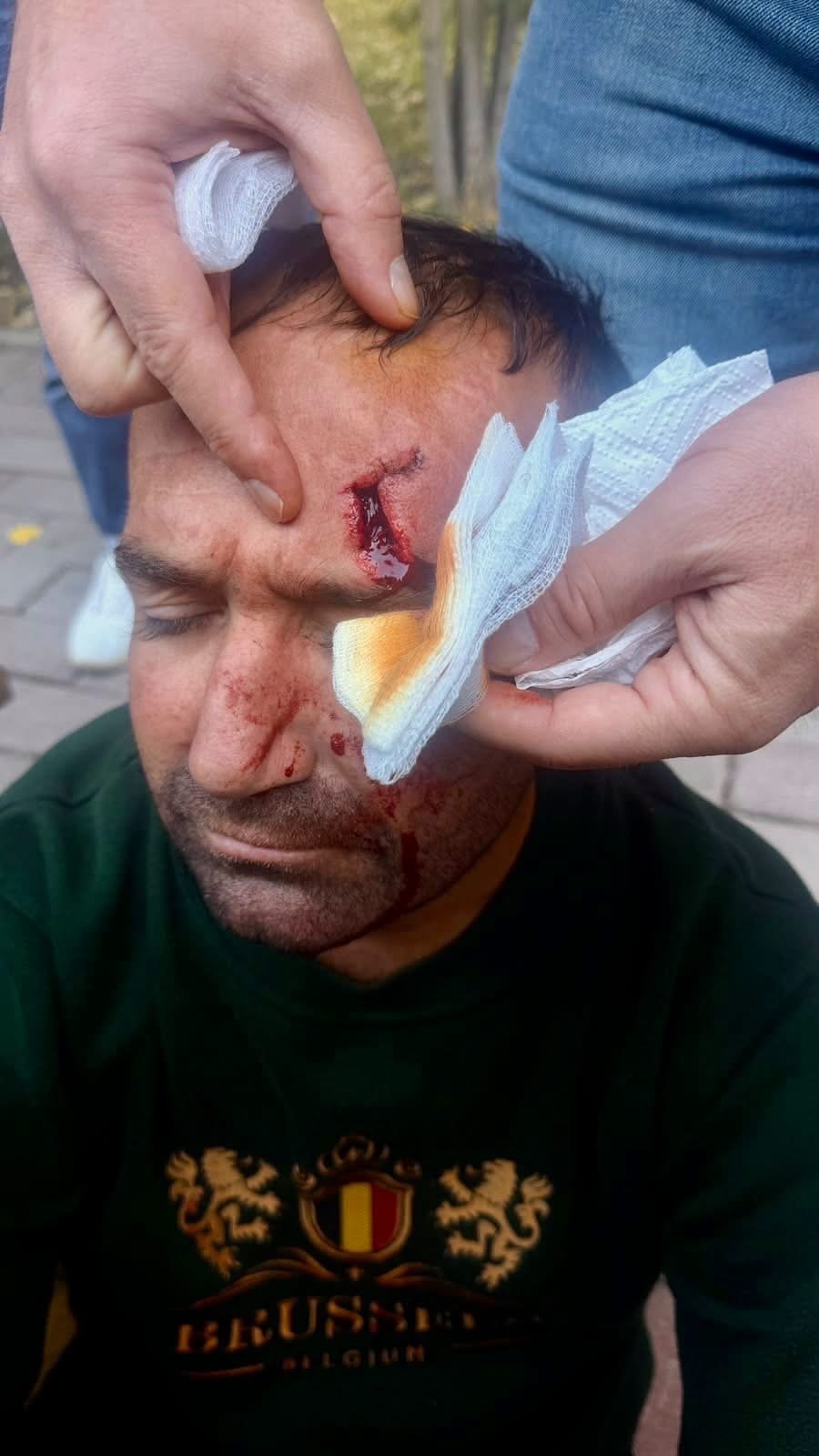 Dhuna e policisë ndaj studentëve, reagon Ambasada Gjermane